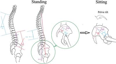 An artificial neural network model based on standing lateral radiographs for predicting sitting pelvic tilt in healthy adults